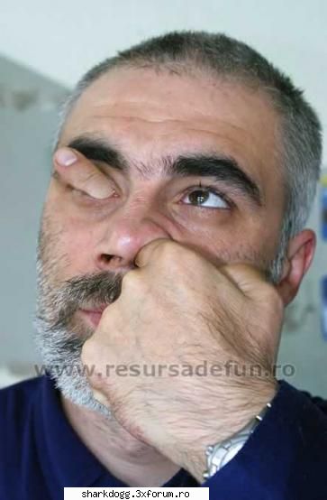 Poze Haioase !!! - Funny Rau De Tot !! - Nu te scobi in nas - Fotografie